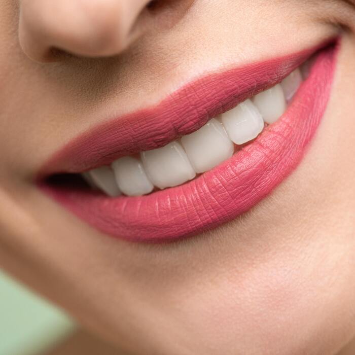 Esthetische - Gezonde mooie tanden